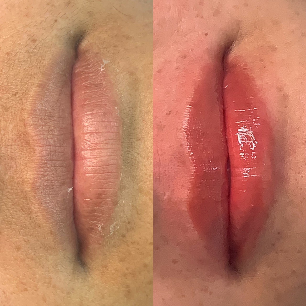 Hidragloss Lips